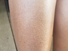Dry Skin?