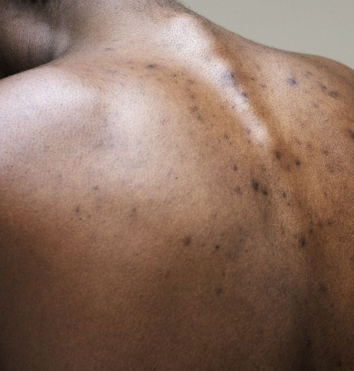Dark Marks